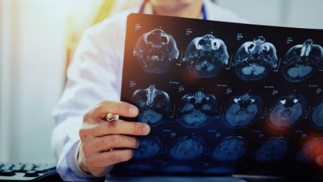Médecin avec des scanners cérébraux IRM (rayons X)
