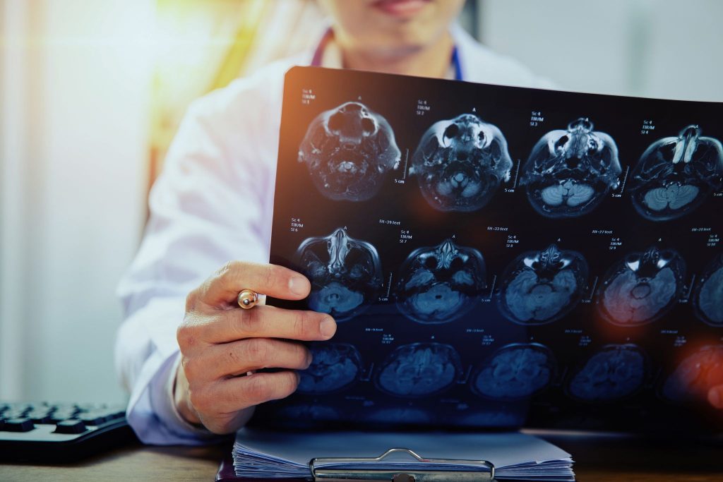 Médecin avec des scanners cérébraux IRM (rayons X)